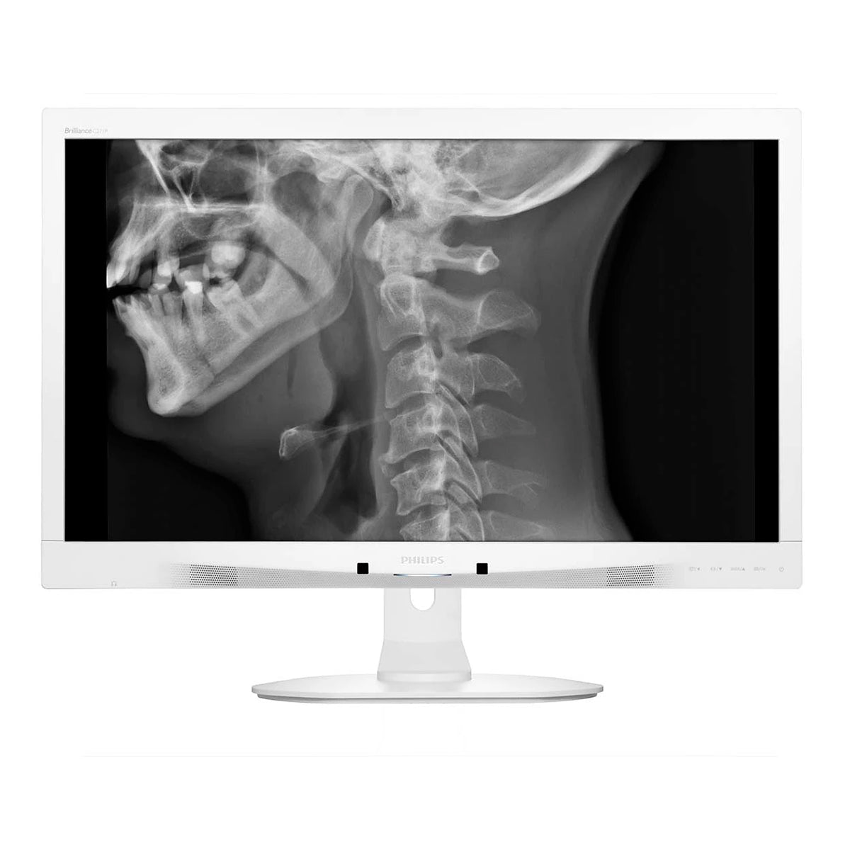 PHILIPS 27" C271P4QPJEW FullHD AMVA 60Hz Clinical D-image Medical Monitor