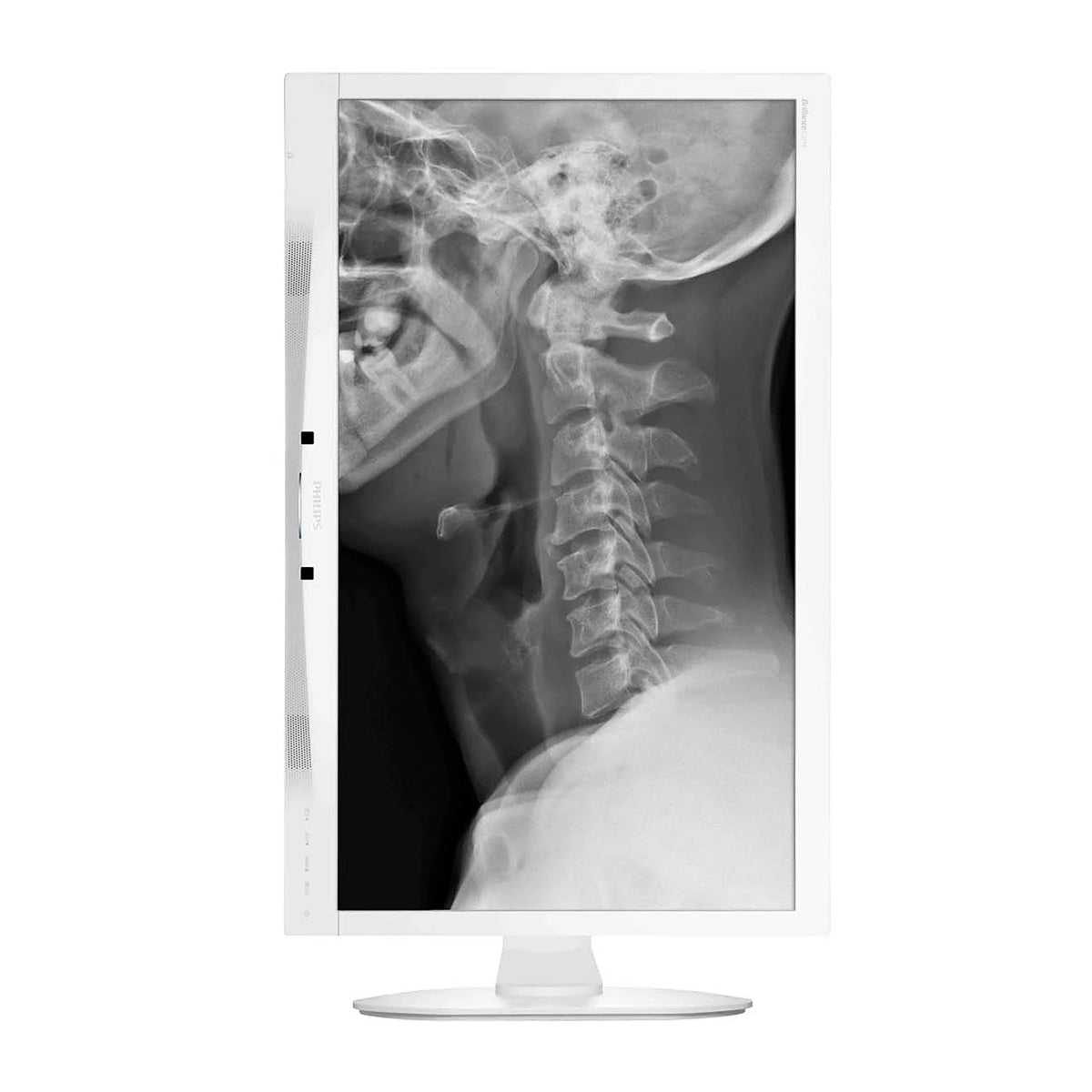 PHILIPS 27" C271P4QPJEW FullHD AMVA 60Hz Clinical D-image Medical Monitor